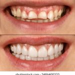 全面解析防屏蔽通道与防屏蔽入口线路的设计与应用 kinxp